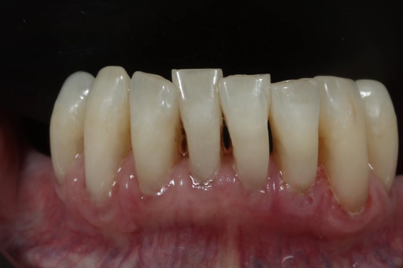 Taking the build-up back off — Hygiene